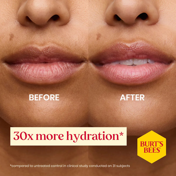 Before and after comparison of lips with Burt's Bees branding and hydration claim.